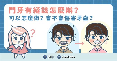 門牙有縫男人|門牙有縫該怎麼辦？可以怎麼做？會不會傷害牙齒？